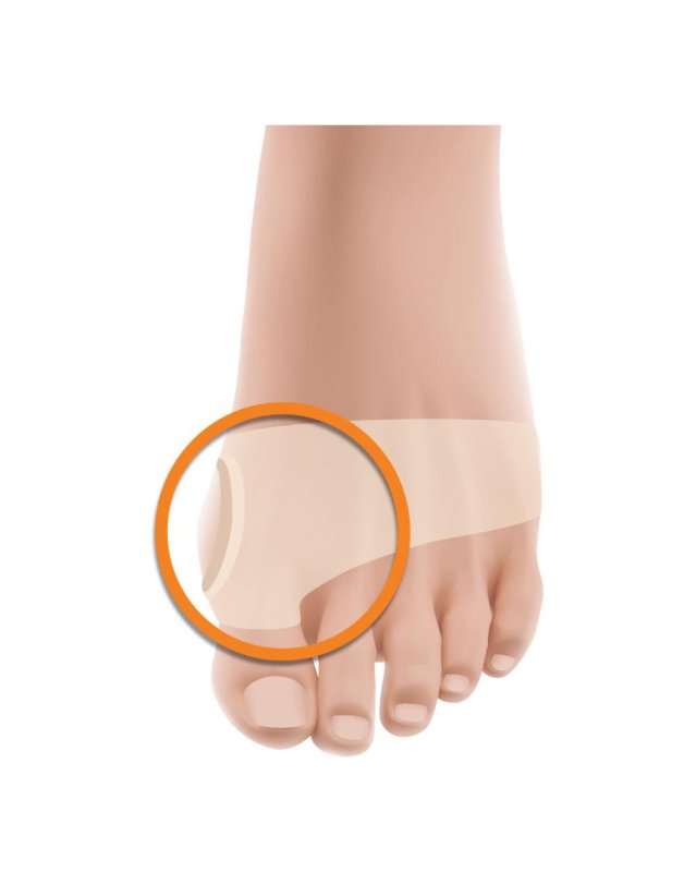 FASCIA PROT ALLUCE VALGO GEL M