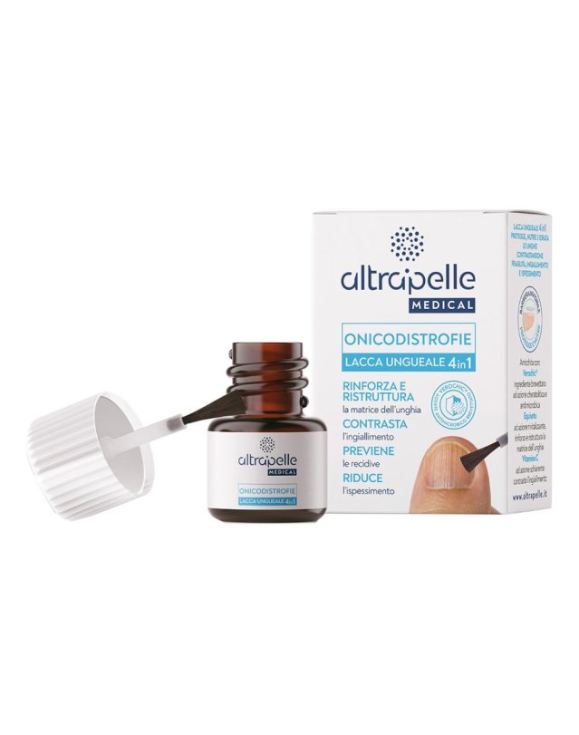 ALTRAPELLE ONICODISTROFIE